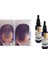 Miracle Drops Saç Bakım Yağı 2
