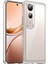 Vivo V50 Lite 5g/4g Kılıf Tpu+Akrilik Koruyucu Şeffaf Telefon Kılıfı-Şeffaf (Yurt Dışından) 1