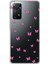 Xiaomi Redmi Note 11 Pro Uyumlu Şeffaf Kılıf Kelebek 2 Tasarımlı 1