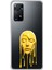 Xiaomi Redmi Note 11 Pro Uyumlu Şeffaf Kılıf Estetik Yüz 6 Tasarımlı 1