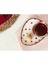 Vie Rouge Sauvage Çay Tabağı - 15 cm 2