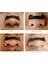 Manyetik Burun Açıcı Aparat (Nasal Dilator- Nefes Açar) 1