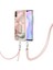 Xiaomi Redmi 9A Yumuşak Tpu Tampon Mermer Kapak Ayrılabilir Kayış (Yurt Dışından) 1