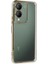 Newface Vivo Y17S Kılıf Razer Lensli Silikon - Gold 1