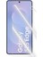 Samsung Galaxy S25 Edge Için Ipg Hydrogel Ekran Koruma 1