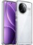 Xiaomi Poco F7 Ultra 5g Elektrokaplama Şeffaf Kılıf Tpu Telefon Arka Kapağı (Yurt Dışından) 1