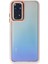 Newface Xiaomi Redmi Note 11 Pro Kılıf Dora Kapak - Pudra 2