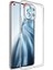 Xiaomi Mi 11 Kılıf Lüx Şeffaf Silikon - KA8573-6490 3