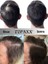 Kızıl/red Hair Saç Sakal Dolgunlaştırıcı Pudra Dip Boya 14 gr 5