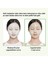 Vt Reti-A Reedle Shot & Hydrogel Mask / Gözenek ve Pürüzsüzleştirici Retinol Maske 5