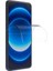 Oppo A55 4g Kılıf Kamera Korumalı Karbon Desenli Lux Negro Silikon - Siyah + Nano Ekran Koruyucu 2