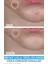 Effaclar Duo +M Pimple Patch Cilt Kusuru Karşıtı Bant 4