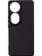 Vivo V40 5g Kılıf Shantime Soft Tpu Silikon Kapak 1