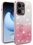Kadem Oppo RENO13 5g (Küresel) Kılıf Çiçek Tpu Esnek Degrade Telefon Kılıfı-Gül Altını (Yurt Dışından) 1