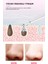 Ultrasonik Spatula Yüz Temizleme Cihazı Siyah Nokta Temizleme Peeling Aleti 5