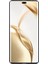 Wanlonfeng Ms Serisi Honor 200 Pro 5g Tpu Kılıf Mat Arka Kapak Temperli Cam (Yurt Dışından) 3