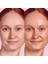 Watermelon Glow Hue Drops - Aydınlık Verici Niasinamid Içeren Serum Rose Glow (40 Ml) 3