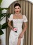 Mottisfashion Zeze Balon Kol Elbise 1