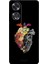Oppo A60 Için Siyah Floral Heart Desenli Silikon Kılıf 1