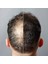 Dr Dermo Hair Saç Kapatıcı Dolgunlaştırıcı Sıvı Krem 30 ml 6