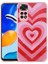 Xiaomi Redmi Note 11 Global Kılıf Simli Desenli Kamera Korumalı Parlak Silikon Popy Kapak 1