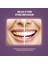 Wonder White Incir Özlü Diş Macunu 75 ml 3