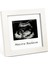 Bebek Ultrason Fotoğraf Çerçevesi 3'lü Triemester, Sonogram Anı Çerçevesi, Yeni Anne Hamile Hediyesi 1