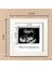 Bebek Ultrason Fotoğraf Çerçevesi 3'lü Triemester, Sonogram Anı Çerçevesi, Yeni Anne Hamile Hediyesi 3