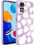 Xiaomi Redmi Note 11 Global Kılıf Kamera Korumalı Desenli Sert Silikon Mnc Epoksi Kapak-No6 1