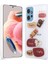 Redmi Note 12 4g Kılıf 3D Figürlü ve Sert Premium Silikon Kapak Ryc/cevze 1