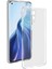 Xiaomi Mi 11 Lite Lux Seri Premium Şeffaf Silikon Kılıf 2