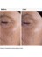 Glikolik Asit 7% Tonik Losyon 240 ml Tüm Cilt Tipleri için Peeling 4