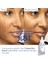Caudalie Vinoperfect Radiance Serum Complexion Cor 50 ml 5