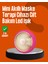 Ufo Mini LED Işık Terapili ve Termoterapili Cilt Bakım Cihazı 1