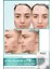 Pimple Patch 22 Adet Akne Karşıtı Bant Tüm Cilt Tipleri İçin 8 Saat Etkili 12