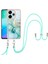 Redmi 13 4g Için Mermer Imd Tpu Kılıf (Yurt Dışından) 2