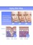 10 Adet 24 Pin Profesyonel Derma Damga Kalemi Microneedle Kartuşları Iğneler Hydra Tabancası S (Yurt Dışından) 5
