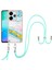 Redmi 13 4g Için Mermer Imd Tpu Kılıf (Yurt Dışından) 2