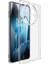 Oneplus 13 Için Ux-5 Tpu Kılıf (Yurt Dışından) 1
