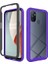 Oneplus Nord N100 Için Starry Sky'ın Pc + Tpu Kılıfı (Yurt Dışından) 2