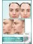 Pimple Patch 22'li Sivilce Bandı/hidrokolloid Bant 5