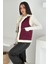 Kadın Peluş Kenarlı Cepli Yelek – Kontrastlı & Kışlık Stil 1