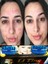 Kore Kozmetik Yüz Güzellik Kremi Gece & Gündüz Yüz Bakım Kremi (2X20ML) 4