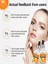 100 % Organic C Vitamini Cilt Serumu Adınlatıcı Ölü Deri Siyah Halka Akne Kararma Karşıtı Serum 5