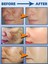 Pyary Freckles - Sunburn- Age Spots - Cyasma - Chloasma- Radiation Spots Acne Cream 3