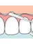 Tepe Bridge & Implant Floss (Diş Ipi) 1