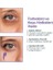 Clasycare Göz Altı Kremi - Kafein%5 + Hyaluronik Asit%2 - Morluk, Torba ve Şişlik Karşıtı Göz Kremi - Kırışıklık, Ince Çizgi ve Göz Altı Aydınlatıcı Krem, 40 ml 1