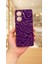 Xiaomi Poco X7 Pro Zebra Desenli Silikon Darbe Emici Klasik Korumalı Rubber Kılıf 2