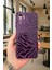 Xiaomi Redmi Note 10 ve 10S Uyumlu Zebra Desenli Silikon Darbe Emici Klasik Korumalı Rubber Kılıf 2