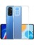 Xiaomi Redmi Note 11 ile Uyumlu Kapak Kamera Korumalı Şarj Yeri Tıpalı Şeffaf Silikon Kılıf 1